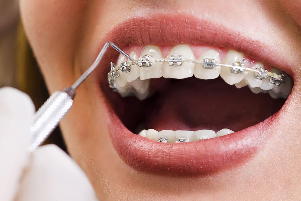 Service Orthodontie Innovante - Cabinet du Dr Nader Maqboli