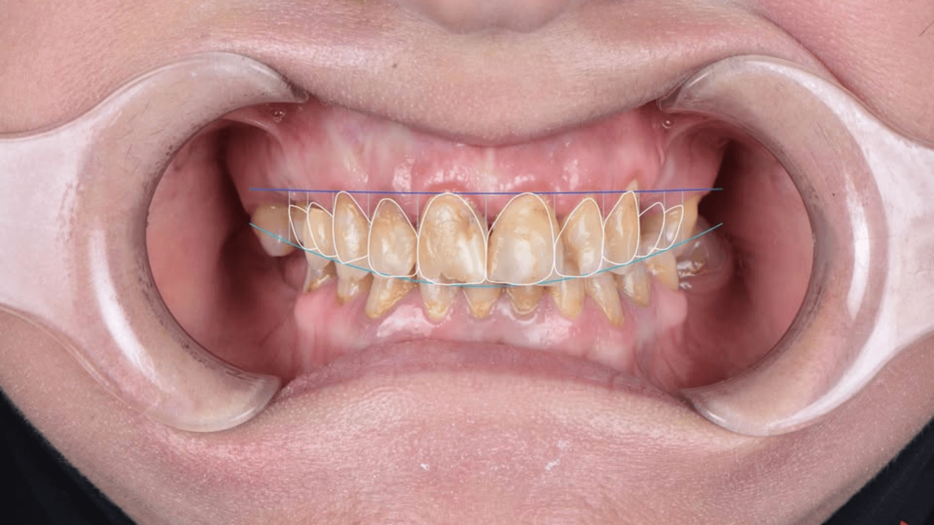 Cabinet du Dr Nader Maqboli - Technologies avancées en dentisterie moderne à Sidi Bel Abbès