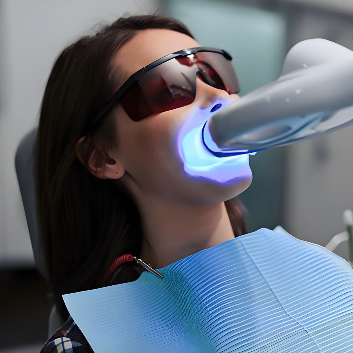 Blanchiment dentaire professionnel - Résultat éclatant